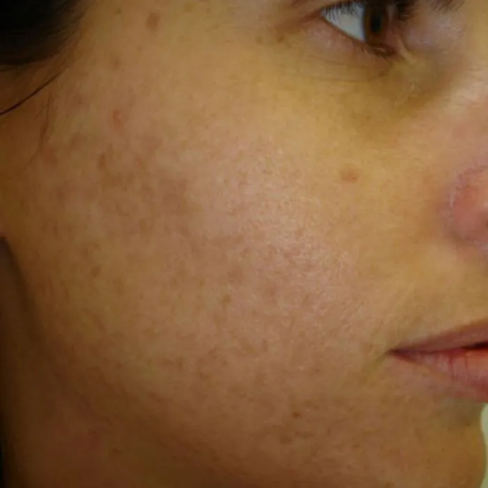 NuShine-LED-After-2 colorado springs