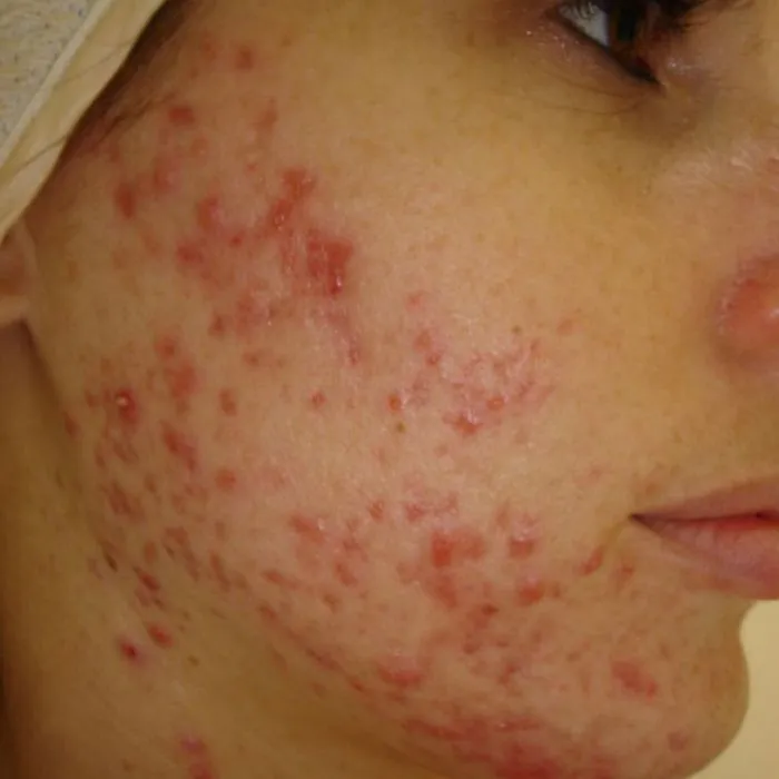 NuShine-LED-Before-2 colorado springs